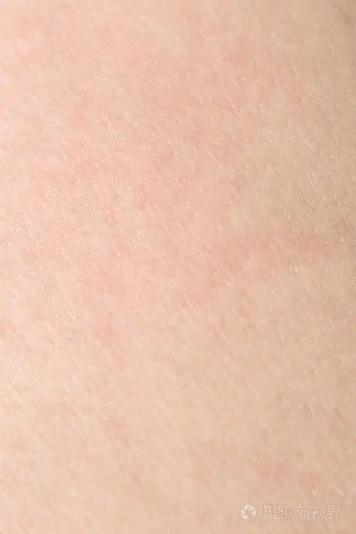 人体皮肤的质地,为健康的回来的皮肤上,黑色的头发照片-正版商用图片1