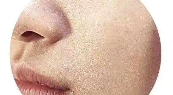 肌肤的敏感常常会困扰爱美的美女们 敏感皮肤的九点护肤原则