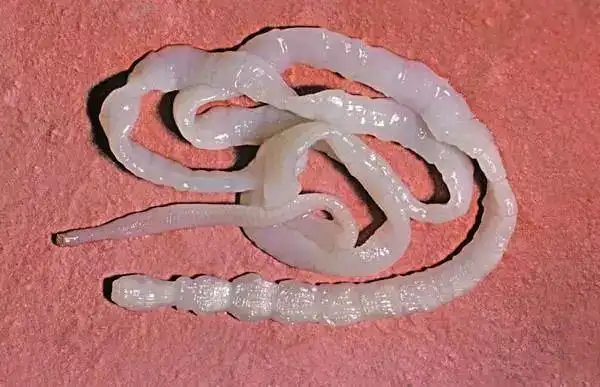 【信偏方出大事】桐乡阿姨乳房里取出虫 因当年生吃3只青