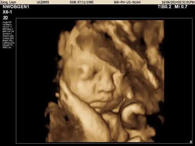 为什么胎儿四维照"丑相"?b超医生告诉你真相,原因是这三点