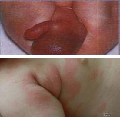 一附院儿一科主任做客健康家园名医大讲堂——浅谈新