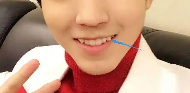 26 6767我们每个人的嘴巴中都有两颗尖尖的牙齿,那就是虎牙