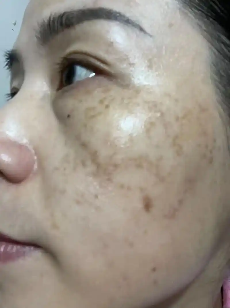 图片上的经销商和顾客,都是杨华亲自调理好的皮肤,你们也可以见 - 抖