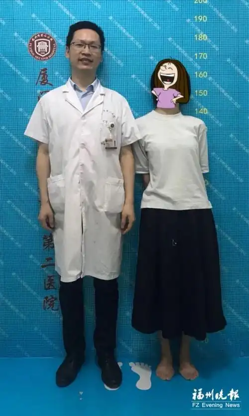 顺利完成 术后三周小兰顺利出院 术前她的身高是139厘米 术后她长高了