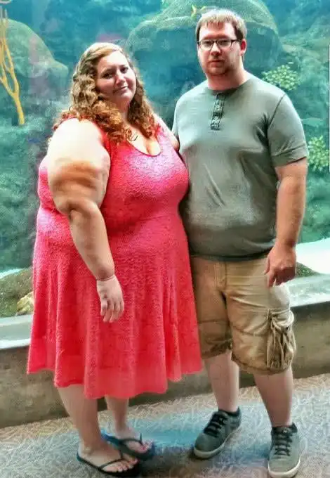 胖女生减重140公斤,皮肤松弛全身赘皮,动10万手术后美成仙