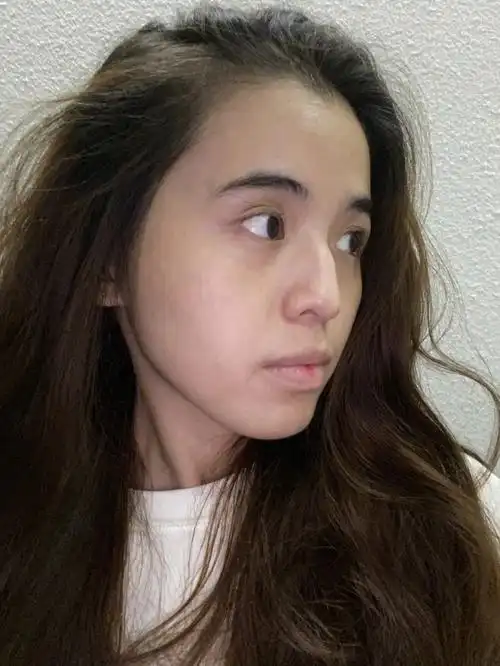 这叫什么鼻型01突出一块