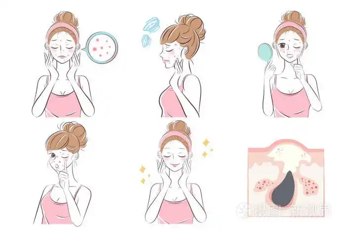 卡通美丽女人之前和之后的鼻子上的粉刺问题