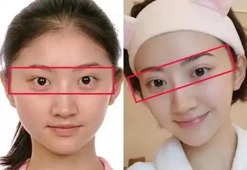 "人间真实"景甜:做双眼皮惨变悲伤蛙!真正的美,是恰到好处