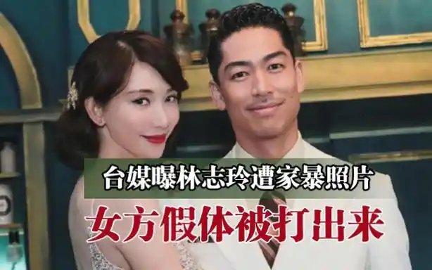 台媒曝林志玲遭家暴照片,女方假体被打出来,日本老公疑似出轨