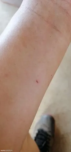 被锈铁弄了个小伤口,是否需要打破伤风疫苗.