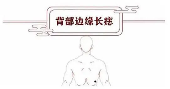 背上长痣图解背上长痣有何含义
