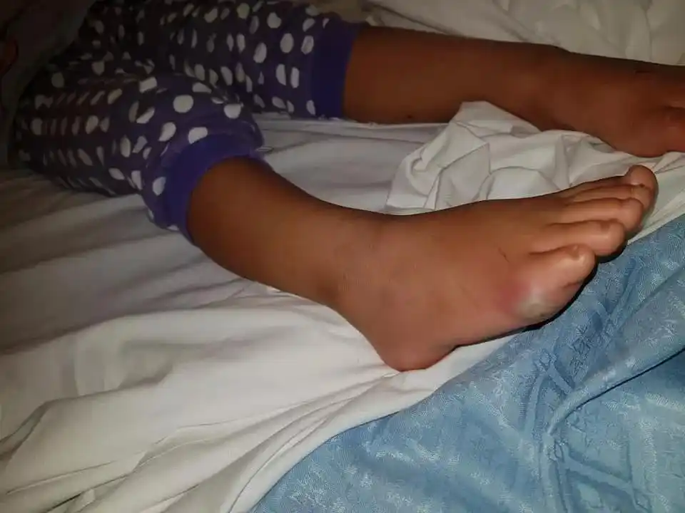 女童光脚试鞋竟染败血症带孩子挑鞋应注意这4点