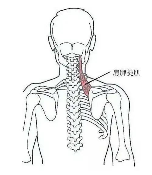 肩胛提肌的松解与拉伸