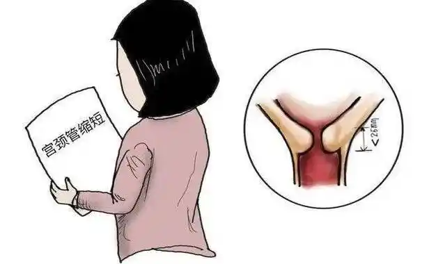 热腾腾!子宫发育不良什么意思"举不胜举"-第2张图片-米兔博客