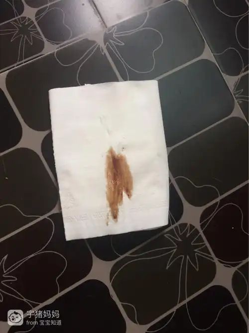 20 09:02     为您推荐: 其他回答 我一个多月的时候也有褐色分泌物