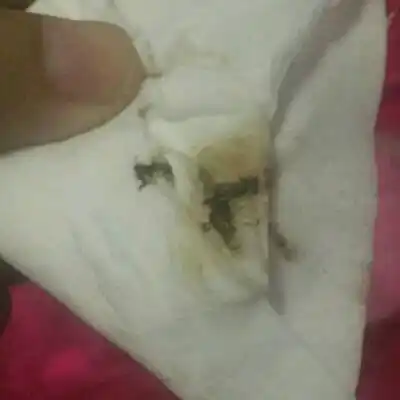 第一次怀孕没什麼