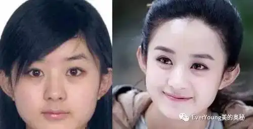 赵丽颖有过磨骨的经历,由"大饼脸"凶悍女变"v脸"小清新.