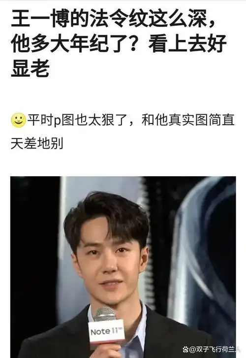 王一博新剧状态堪忧整容后遗症明显年代戏镜头里全暴露