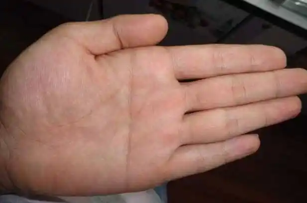 男人左手断掌掌财库