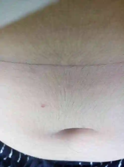 民间谣传肚子长毛能看性别那是男孩还是女孩呢