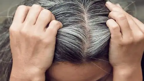 血热是长白发的一个原因为什么有人会出现血热呢来了解了解