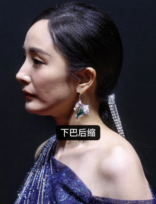 再细看照片,还能发现杨幂有着明显的下巴后缩,而且女性随着年龄变大而