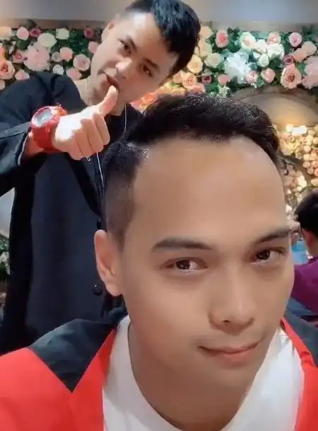 男生秃头顶发型 - 搜狗图片搜索