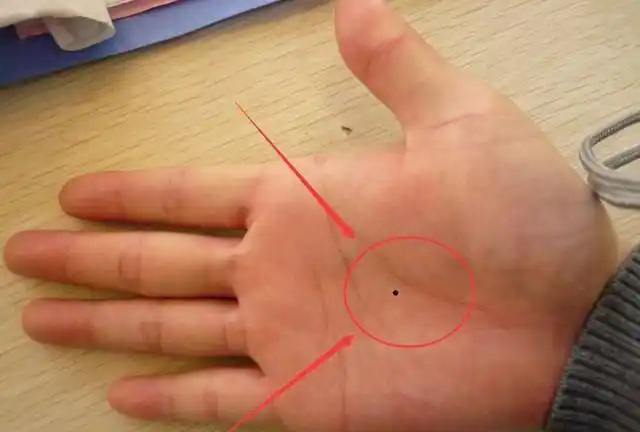 掌心有痣的人聪明又福贵,但是下面这几种手掌的人愚笨贫贱