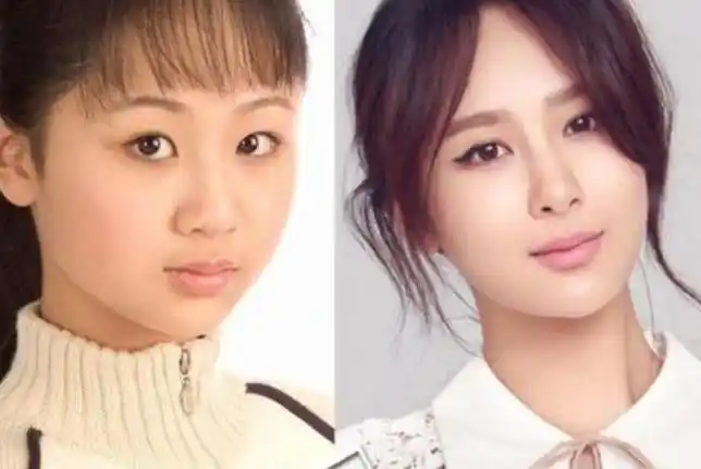 杨紫打瘦脸针前后对比照 她的眉毛前后也不同图片