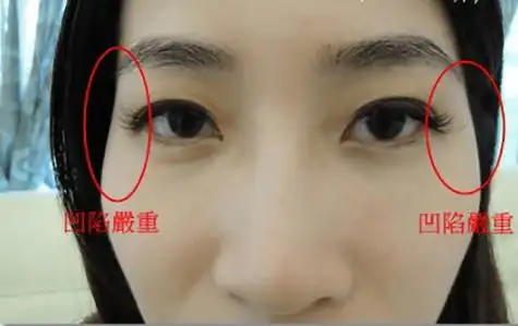 面相丨夫妻宫凹陷的女人会离婚?夫妻宫在哪,怎么看?_婚姻_异性_感情