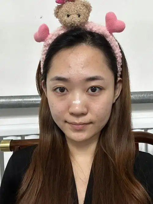 这是普通人的素颜吗