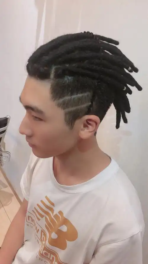 脏辫头皮疼一般痛痒多久宽厚里脏辫