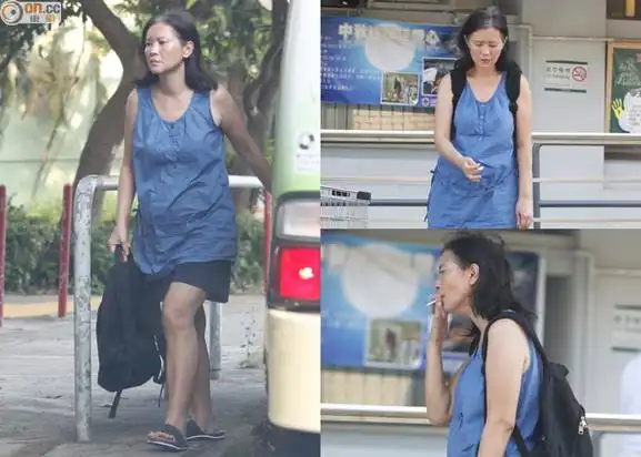 51岁蓝洁瑛罕见现身四肢浮肿老态龙钟图