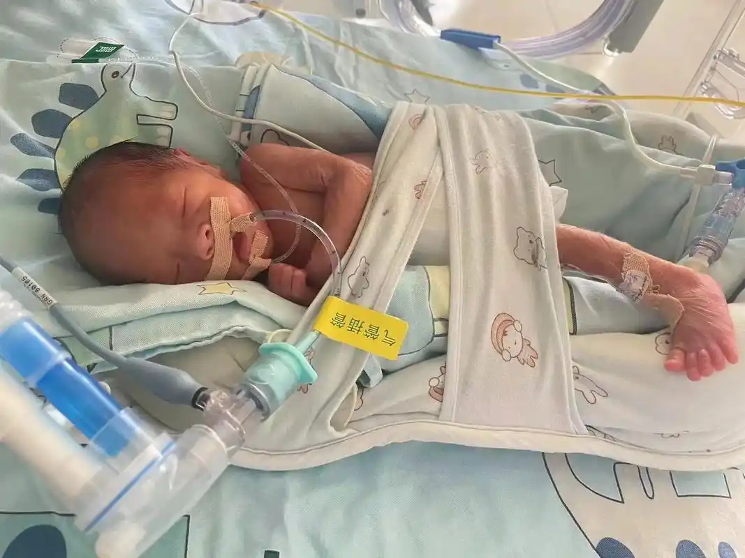 26周早产双胞胎宝宝第十六天