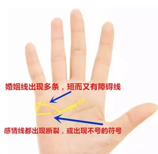 3:这位女士的手相指骨暴突,手指无形,生命线起端开叉,运势根基极差