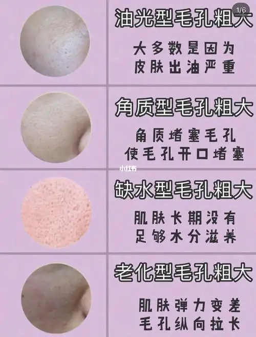 毛孔粗大的,快点进来!全面科普