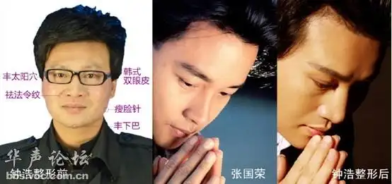 "人造张国荣"钟浩照片曝光,多次整容成张国荣开演唱会!