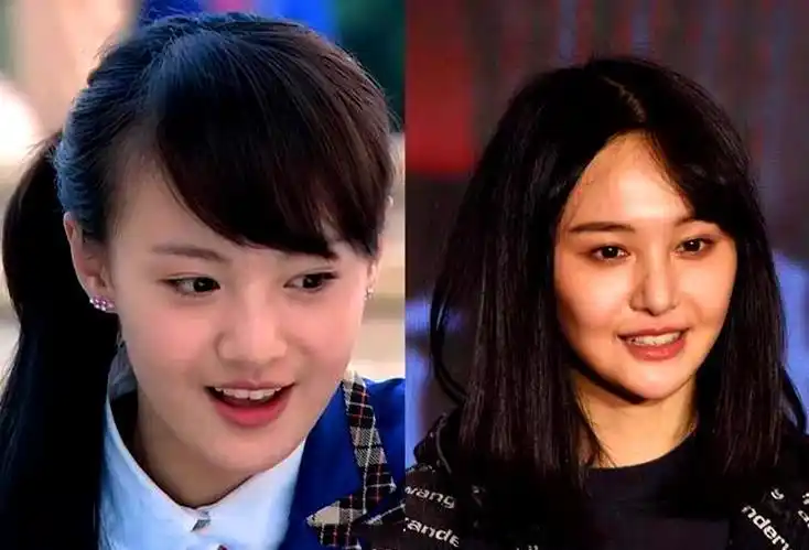 郑爽偷税被罚2.99亿照片曝光,整容导致苹果肌僵硬?自曝不能生育