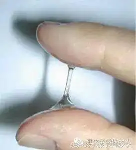 如周期后延者,排卵时应在下次月经来潮前14天. 2,白带性状.