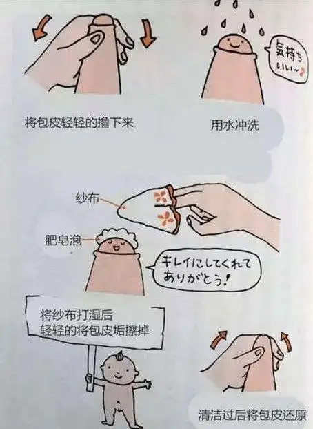 包茎|包皮过长|包皮炎_网易订阅