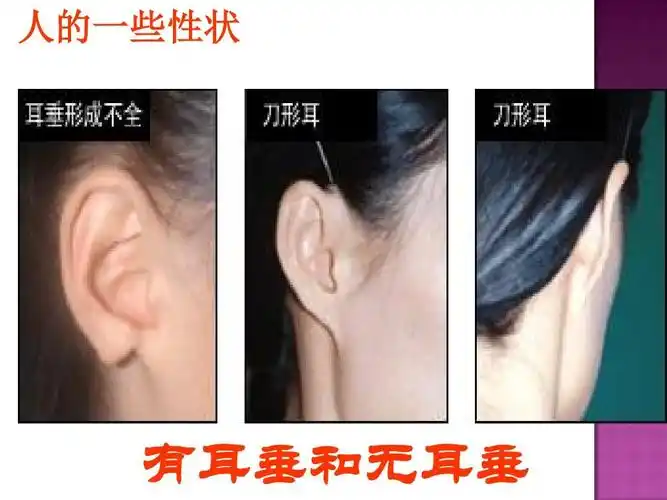 人的一些性状 有耳垂和无耳垂