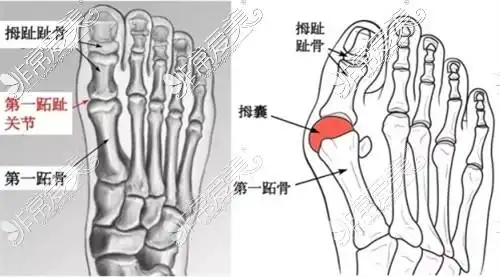 大脚骨的足底结构示意图