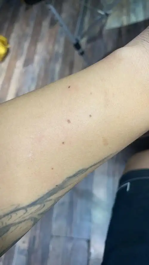 有人身上有北斗七星痣吗