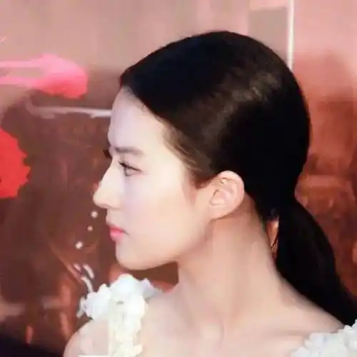 整头级颅顶增高术花最少的钱让你的脸变小一圈