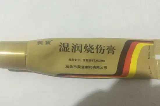 2,涂抹烫伤膏