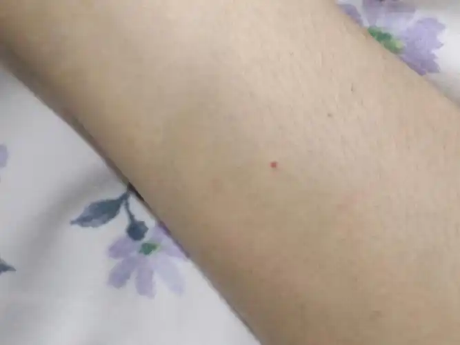 右手臂内侧有一颗朱砂痣诶