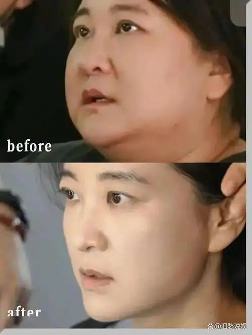 贾玲整容式现状曝光大波浪晚礼服暴瘦1000现杀疯了