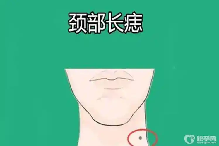 女人脸上十大吉痣有一个就是富贵相快来看看你有几个