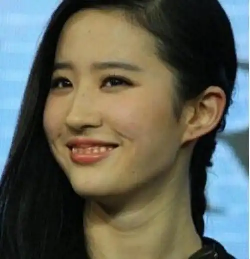 专家|问答|刘亦菲_新浪女性_新浪网