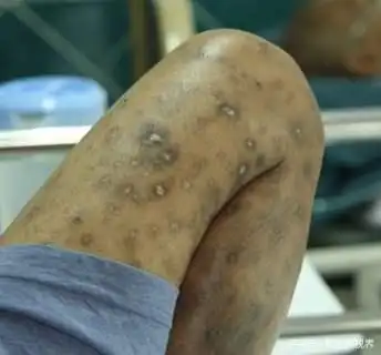 荒唐!谁为艾滋病买单?